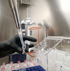 RNA extraction services [Human Blood/FFPE tissues]